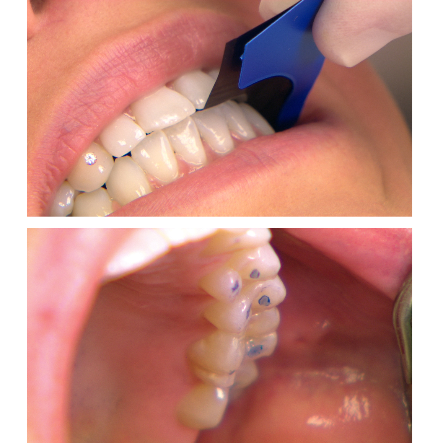 TROLLFOIL BLUE, 500 PCS - Premium Articulating Paper - Image 2