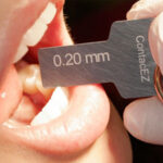 ContacEZ Incremental Thickness Gauge